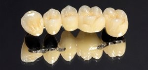 Зубы из металлокерамики фото