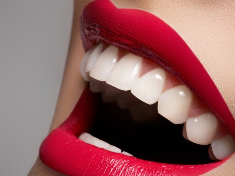 Металлокерамические коронки на зубы - эстетический прорыв в протезировании зубов