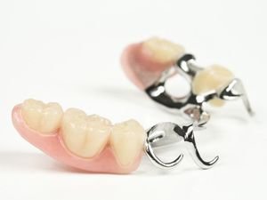 Особенности установки зубных протезов