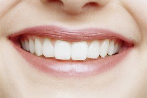 Сколько стоит вставить передний и остальные зубы?