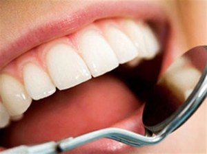 Зубные нейлоновые протезы: описание и фото