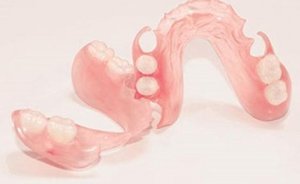 Недостатки нейлоновых зубных протезов