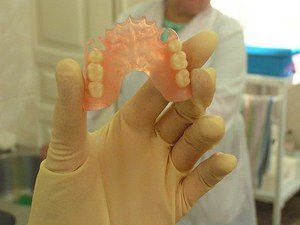 Установка нейлоновых зубных протезов