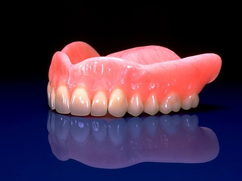 Как устанавливается нейлоновый зубной протез