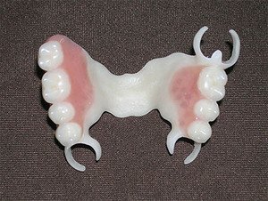 Пластмассовый зубной протез