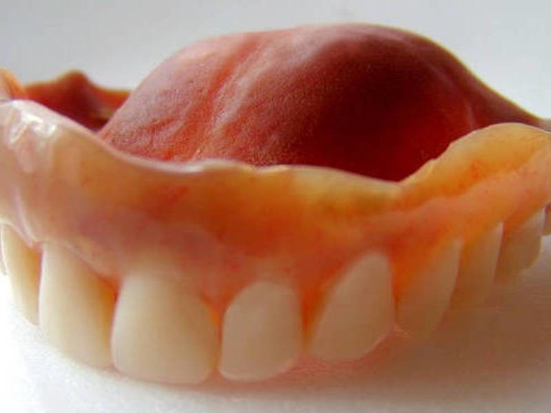 Технология изготовления силиконовых зубных протезов