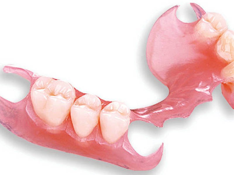 Что такое съемные силиконовые зубные протезы