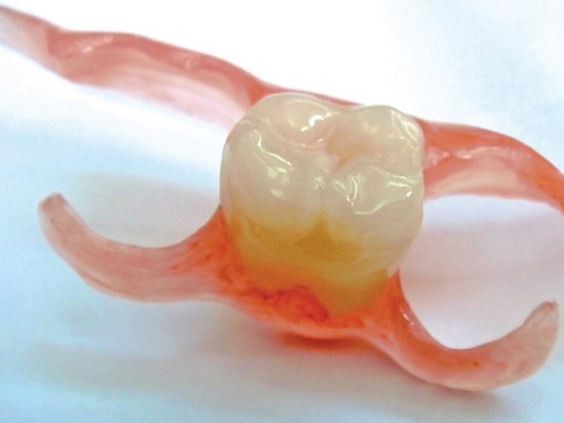Недостатки силиконовых зубных протезов