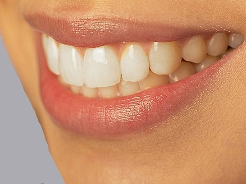 Процесс установки силиконовых зубных протезов