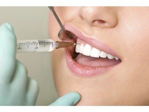 Применение Линкомицина в стоматологии