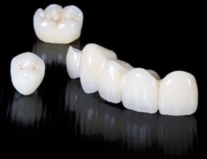 Разновидности зубных коронок