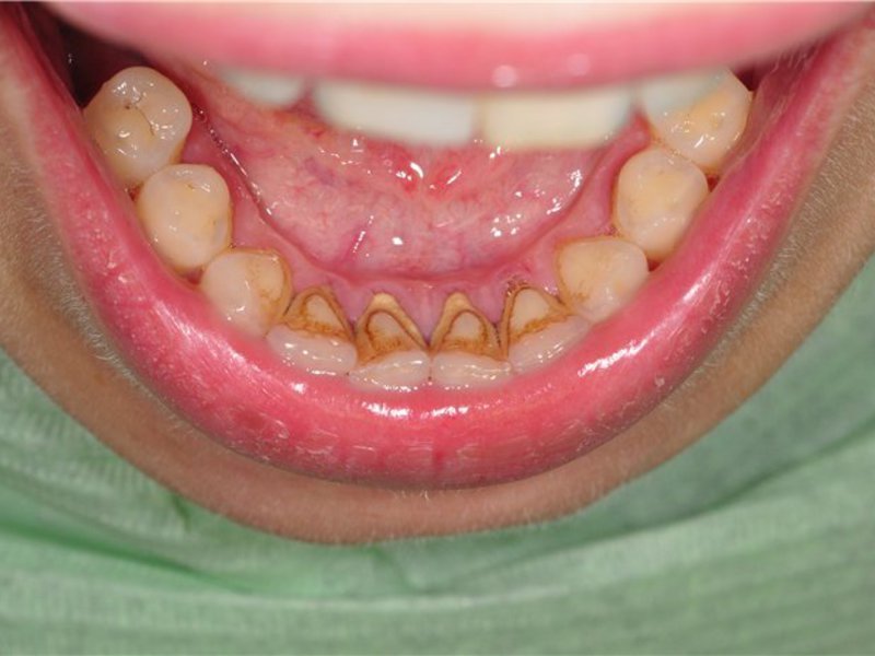 Профилактика и уход за зубами