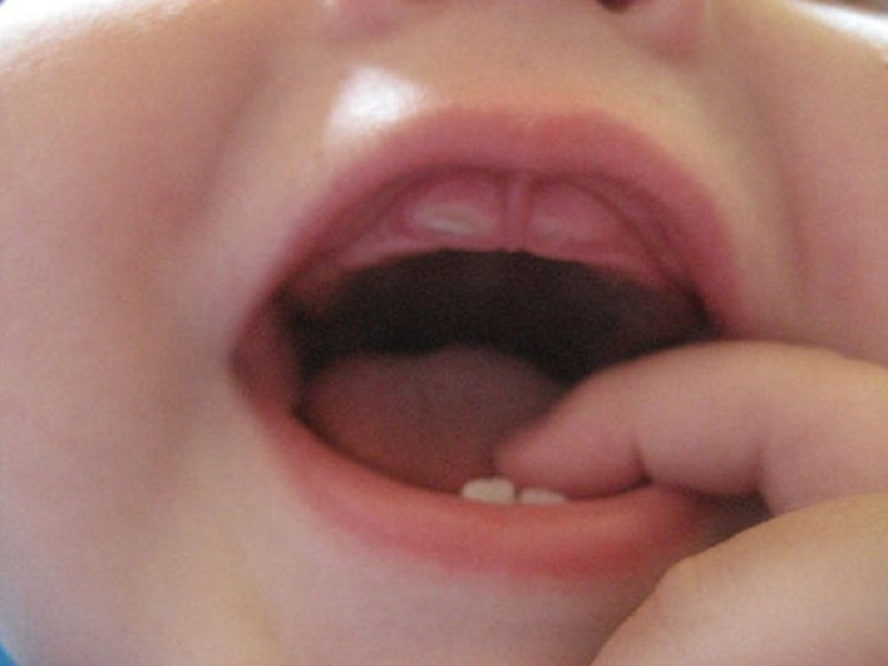 Первые молочные зубки