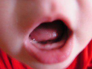 Первые молочные зубки у ребенка