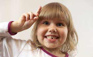 Выпадение молочных зубов у детей, схема замены постоянными