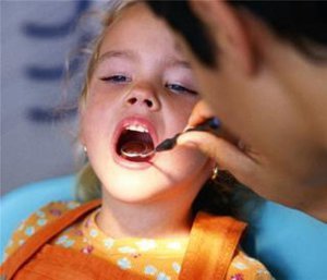 Серебрение зубов у детей: особенности процедуры и отзывы