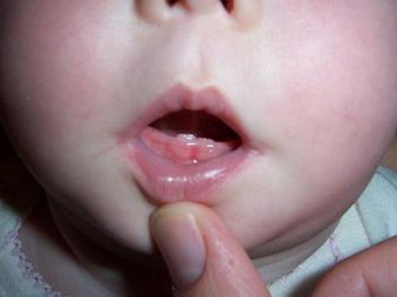 Чем помочь ребенку, когда режутся зубы