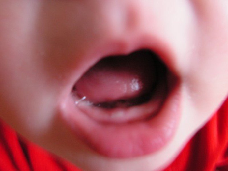 Молочные зубы и малыши