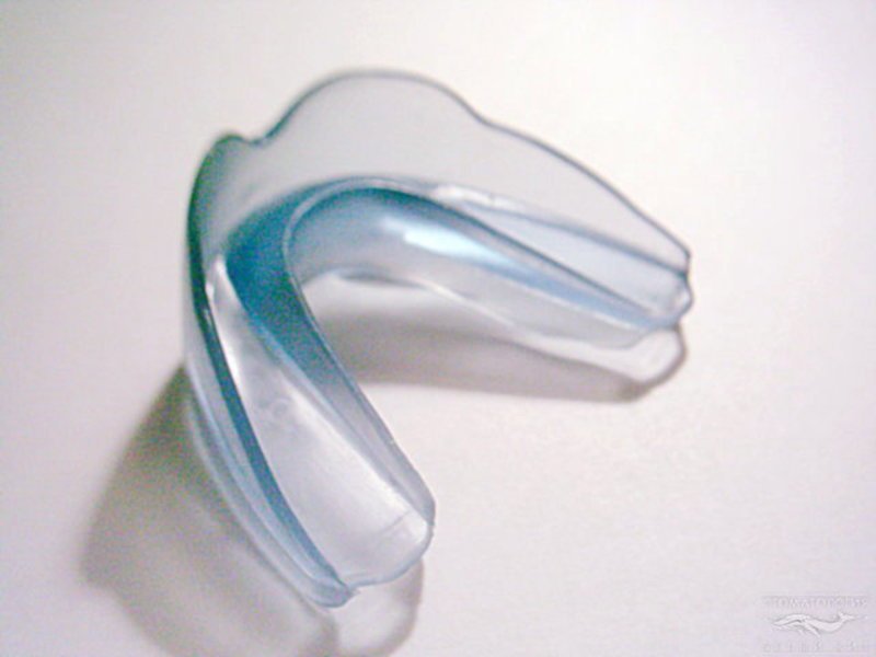 Пластмассовая прозрачная капа