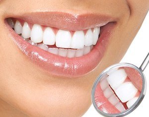 Как выравнить зубы в домашних условиях