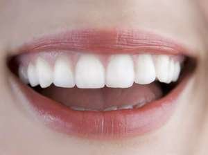 Как выровнять зубы без брекетов в домашних условиях?