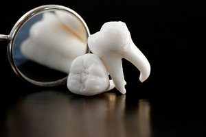 Медицинское описание зубов мудрости