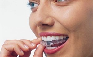 Как самостоятельно выровнять зубы