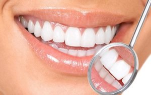 Описание методов выравнивания зубов