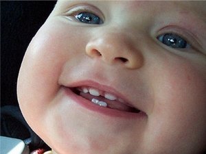 Повышение температуры при прорезывании зубов у ребенка