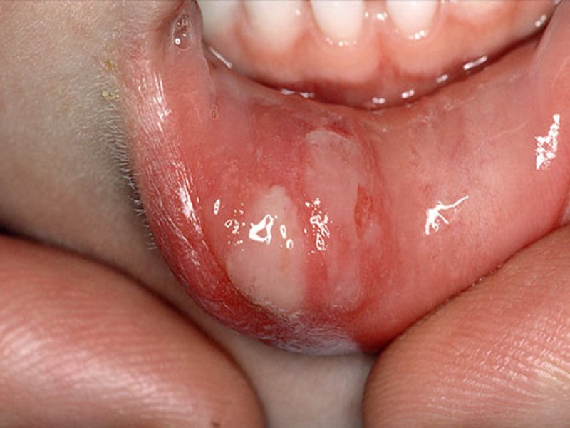 Полость рта у детей