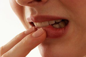 Причины и методы снятия воспаления десны около зуба