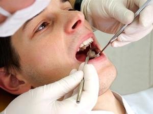 Что такое зубной флюс