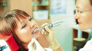 Как очистить зубы ультразвуком