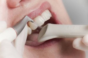 Ультразвуковая чистка зубов: противопоказания, отзывы