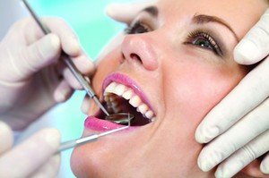 Процедура отбеливания зубов