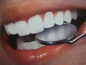 Отбеливание зубов в клинике